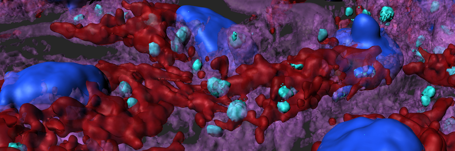 Image: Artistic rendition of macrophages infected with Leishmania major parasites